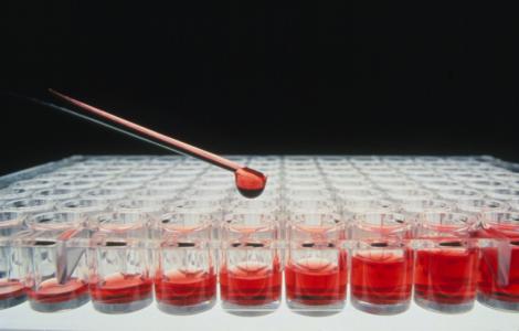 Un test capable de détecter dans le sang plus d'une cinquantaine de types de cancer